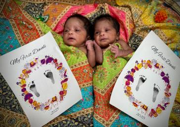 Baby Mitha & Mithu, Baylor Scott & White Medical Center – Frisco at PGA Parkway